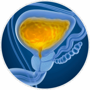Overactive Bladder