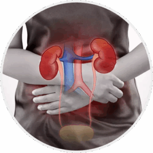 Urinary Tract Infections