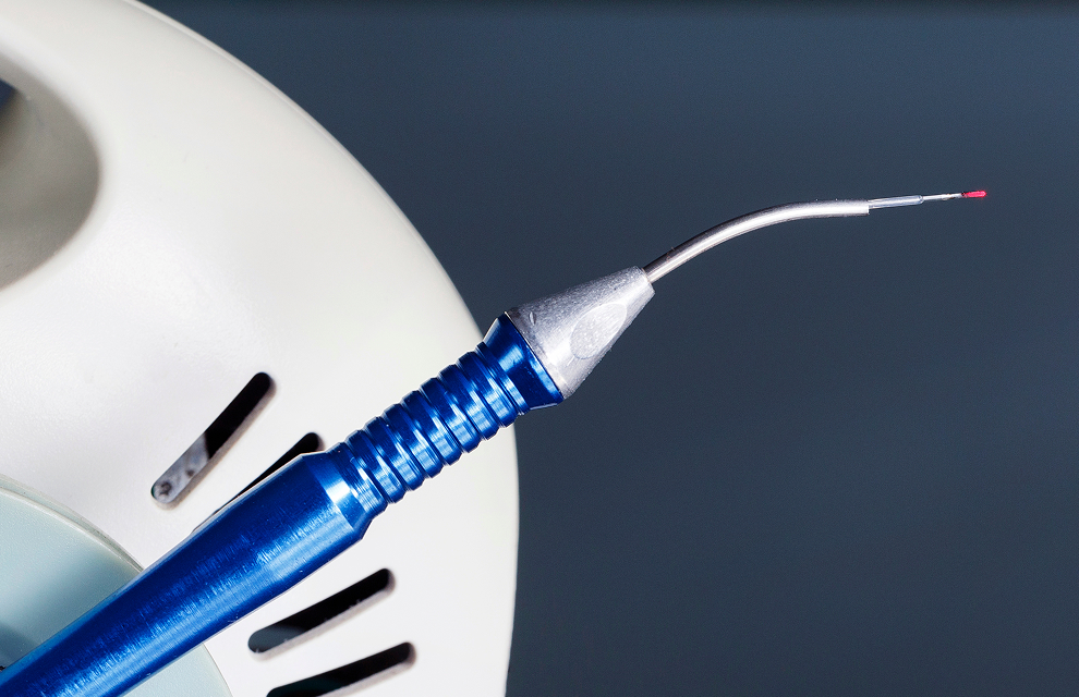 Laser Circumcision