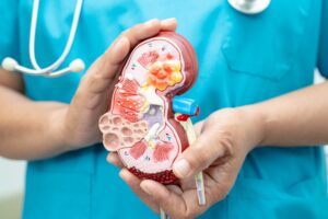 Partial Nephrectomy