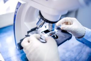Transperineal Prostate Biopsy