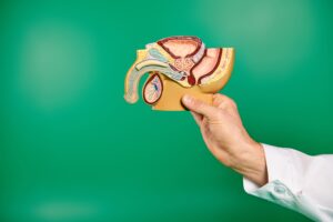 Inguinal Hernia