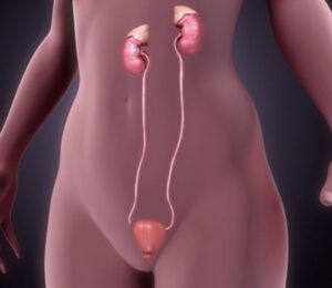 Ureteric Cancer Treatment