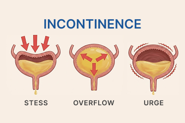 Understanding Urinary Disturbance Related to the Prostate in Singapore