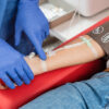 A gradual decline in kidney function identified through blood tests