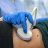 Kidney swelling (hydronephrosis)