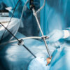 Laparoscopic Surgery